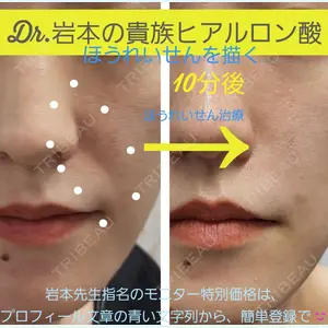 症例