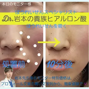 症例
