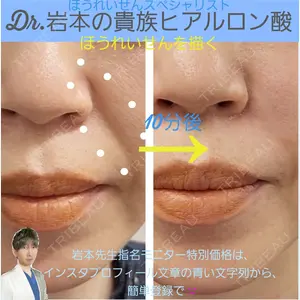 症例
