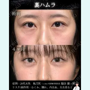 症例