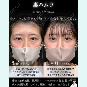 症例