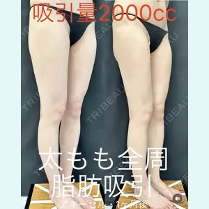 症例