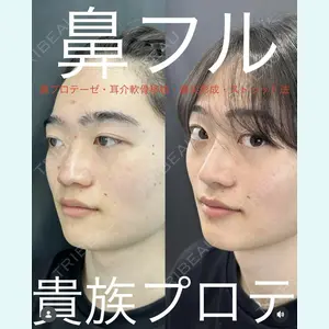 症例