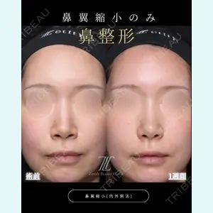 症例