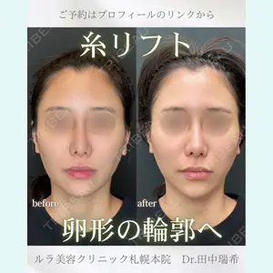 症例
