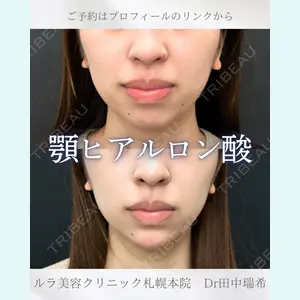 症例