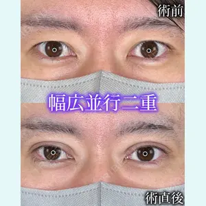 症例
