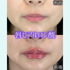 症例