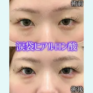 症例