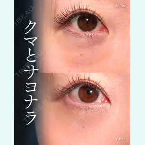 症例