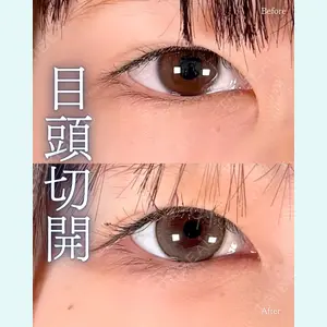 症例