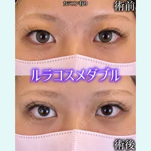 症例