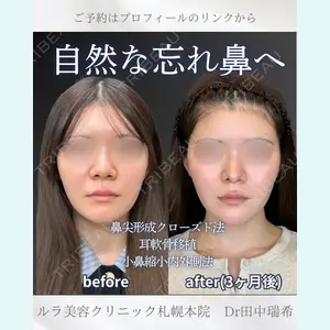 症例
