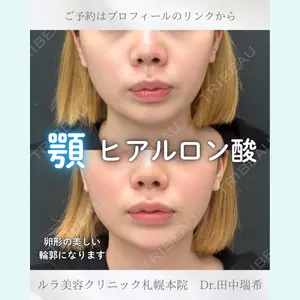 症例