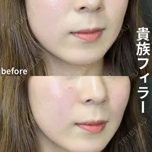 症例