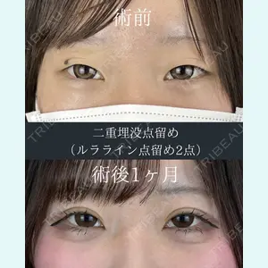 症例