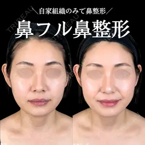 症例