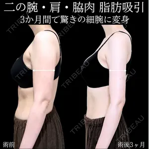 症例