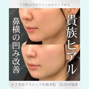 症例