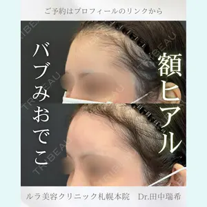 症例