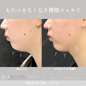 症例