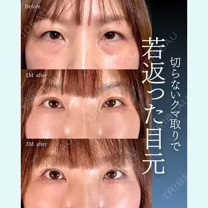 症例