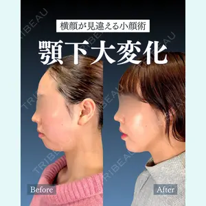 症例