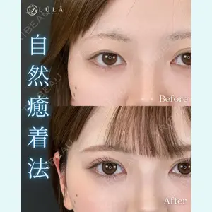 症例
