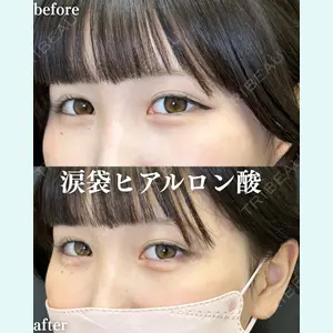 症例