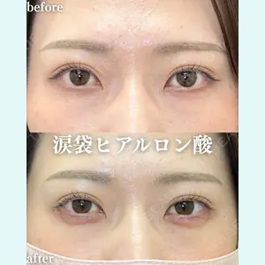 症例