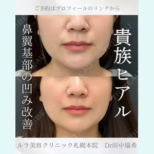 症例