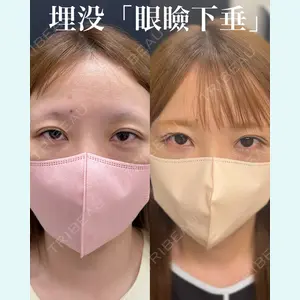 症例