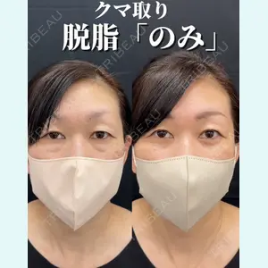 症例