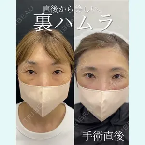 症例