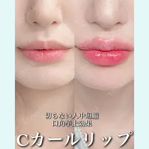 症例
