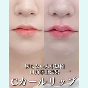 症例