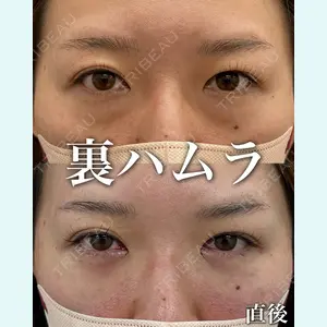 症例
