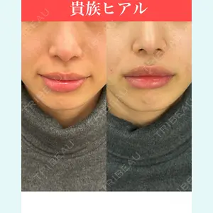 症例