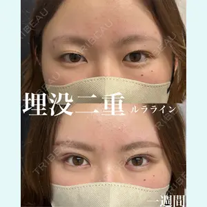 症例