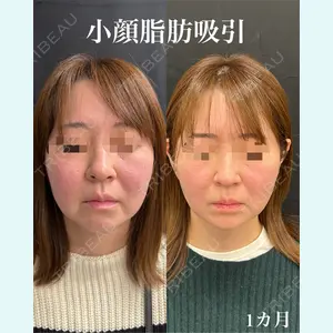 症例