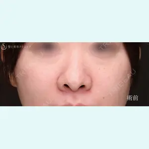 症例