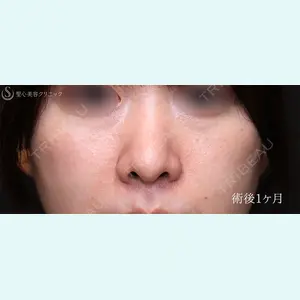 症例