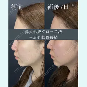 症例