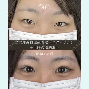 症例