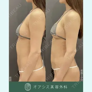 症例