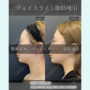 症例