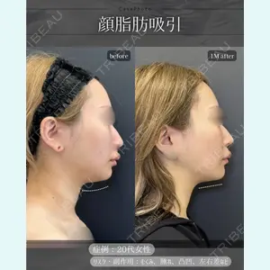 症例