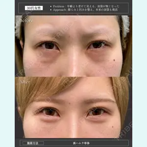 症例