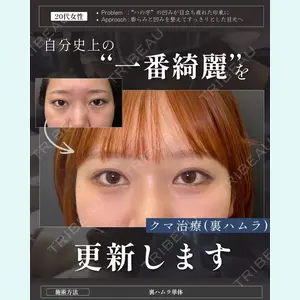症例