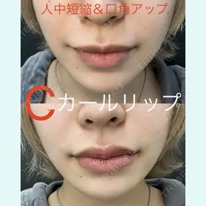 症例